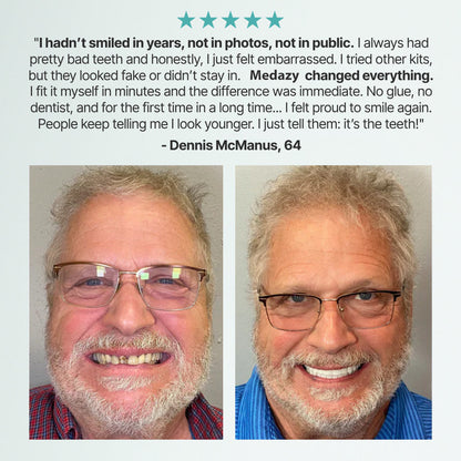 （OFFICIAL STORE）Custom-Fit Full Functional Dentures