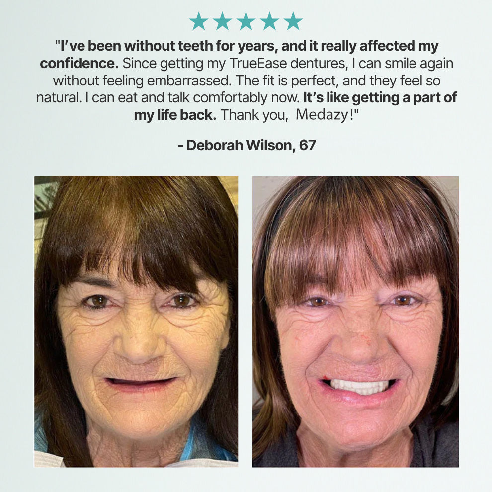 （OFFICIAL STORE）Custom-Fit Full Functional Dentures