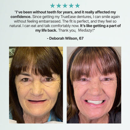 （OFFICIAL STORE）Custom-Fit Full Functional Dentures